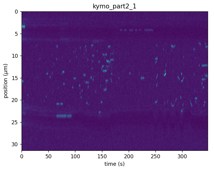 ../_images/kymo_unscaled.png