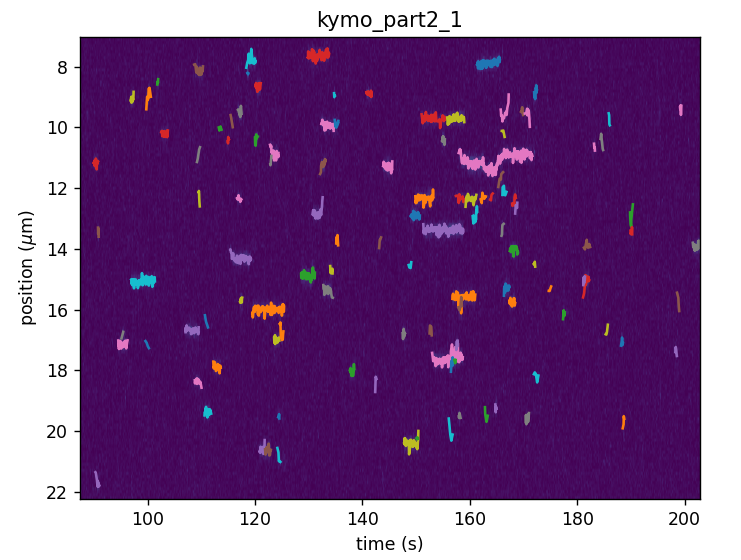 ../_images/kymotracked.png
