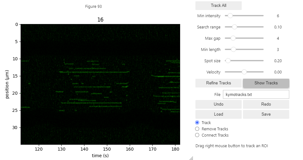 ../_images/kymotracker.png