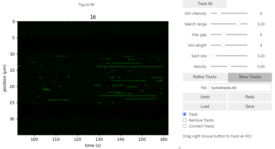 ../_images/kymotracker2.png