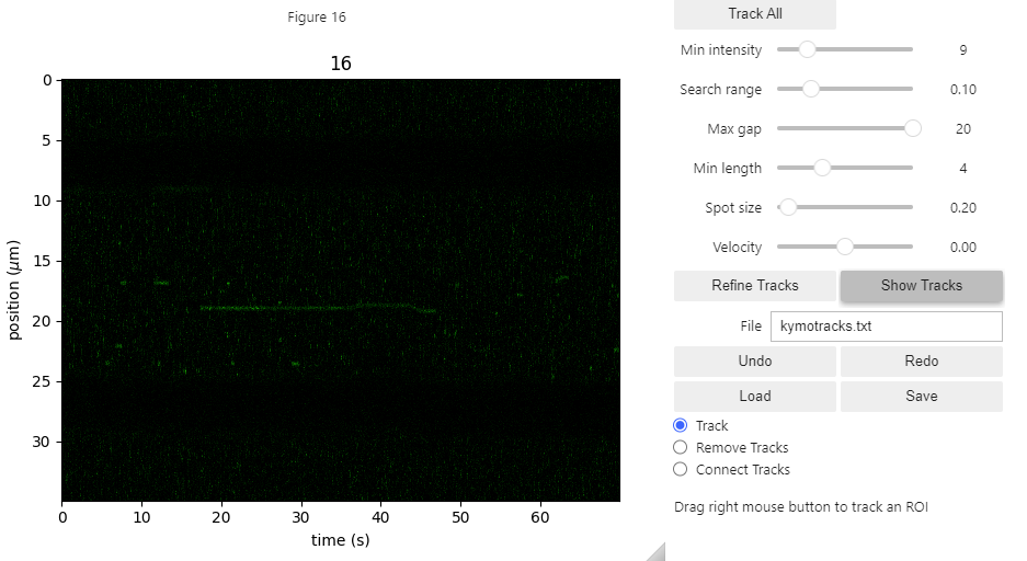 ../_images/kymotracker3.png