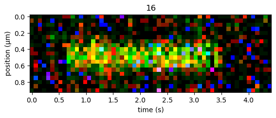 ../_images/kymograph_selection.png